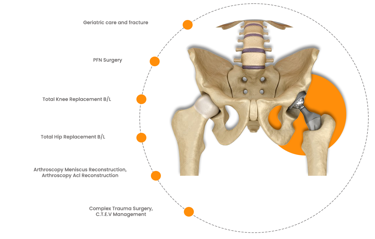 Joint Replacement & Sports Injury