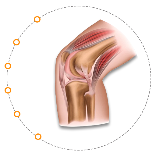 Orthopaedics