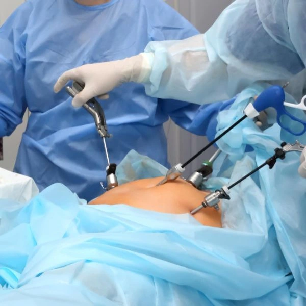 Laparoscopic Hysterectomy Surgery