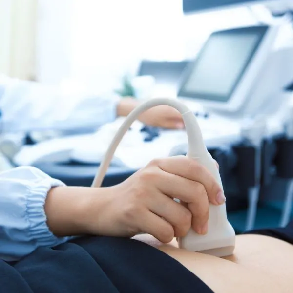 Ovarian cyst